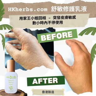 HKherbs.com舒敏修護乳液30ml - 有機/ 全天然草本60日手工浸製，適合濕疹敏感肌